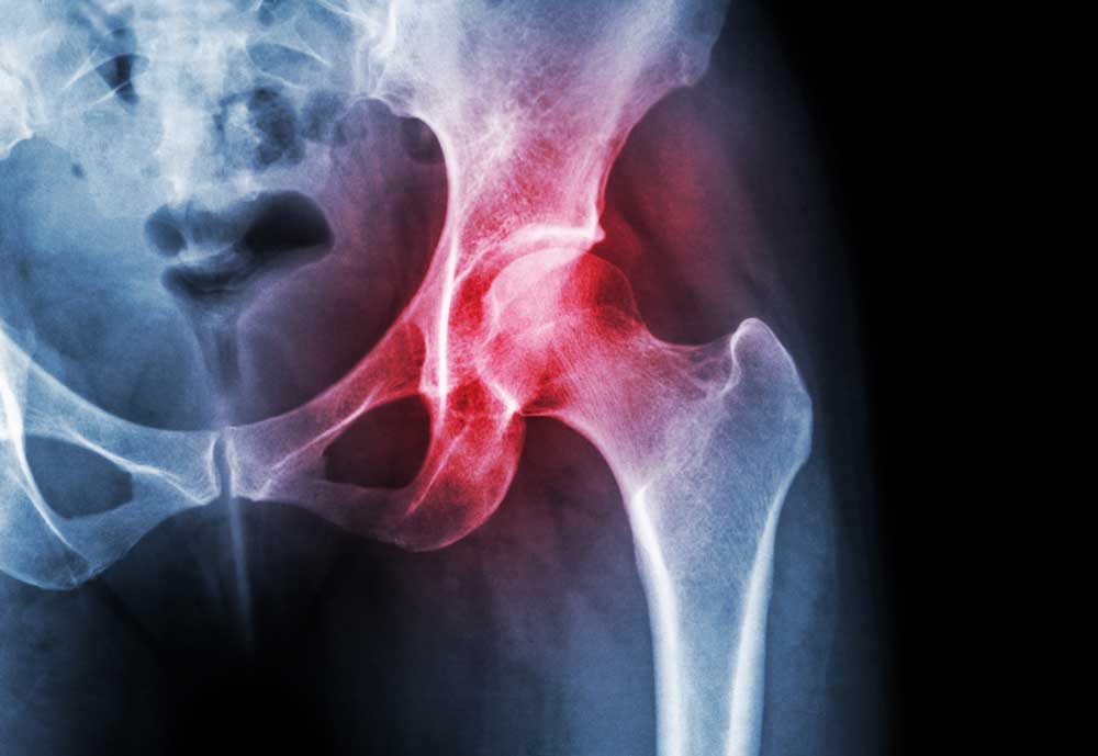 inflamed joint